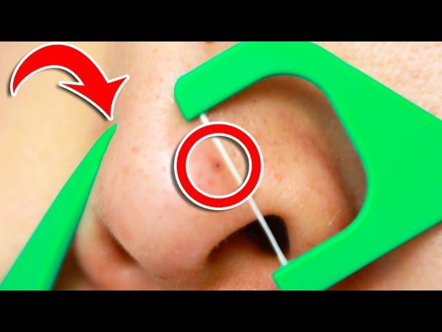 6 Clever Tricks To Unclog Pores INSTANTLY!