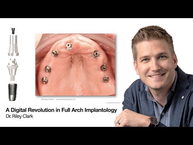 A Digital Revolution in Full Arch Implantology by Dr. Riley Clark