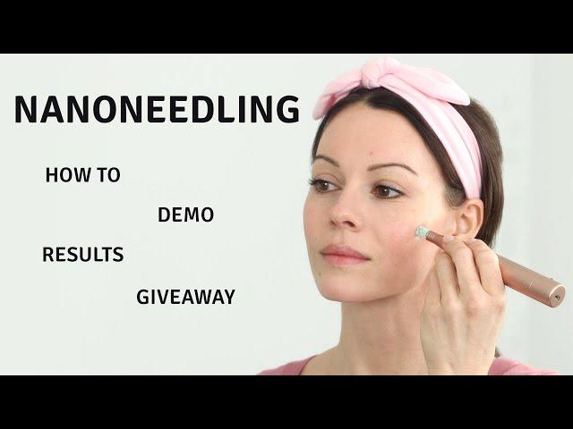 Nano Needling | Everything You Need to Know | +Giveaway