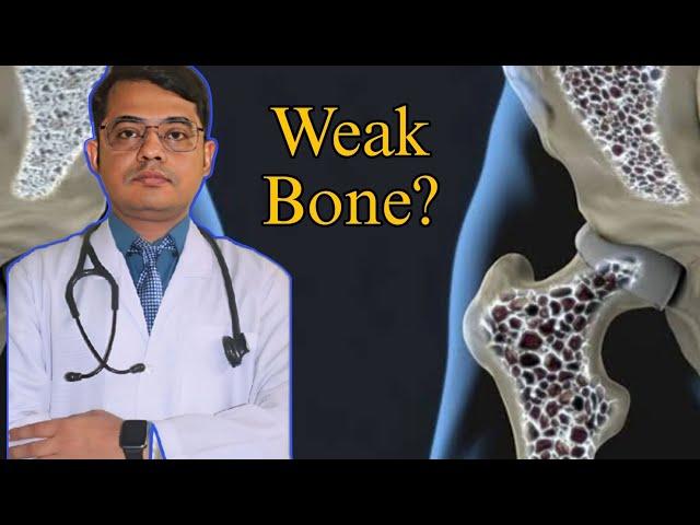 Weak Bone?/Bangla Health Education/Dr.Joydeb Singha