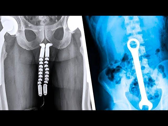 20 Strangest Things Discovered by X-Rays