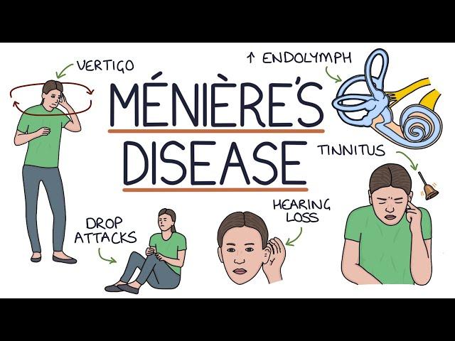 Understanding Ménière’s Disease