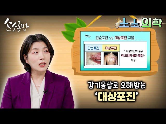 감기몸살로 오해받는 ‘대상포진’ -마취통증의학과 김여정 교수-  / KBS대전 20221025 방송