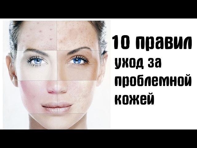 10 ПРОСТЫХ ПРАВИЛ/ Как ухаживать за проблемной кожей
