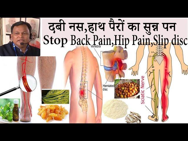 दबी नस,हाथ पैरों का सुन्न पन , Back Pain, Hip Pain, Slip Disc दो हप्तों में होगा ठीक || DR DARBESH