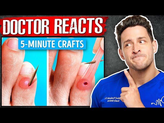 The WORST 5-Minute Crafts “Health Hacks”