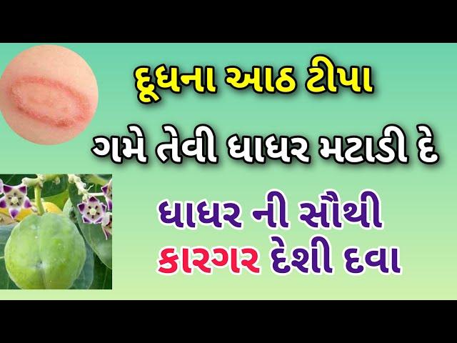 આ દૂધના આઠ ટીપા ગમે તેવી ધાધર મટાડી દે ||ધાધર ખરજવા ની દેશી દવા || Dhadhar ko kaise hataye