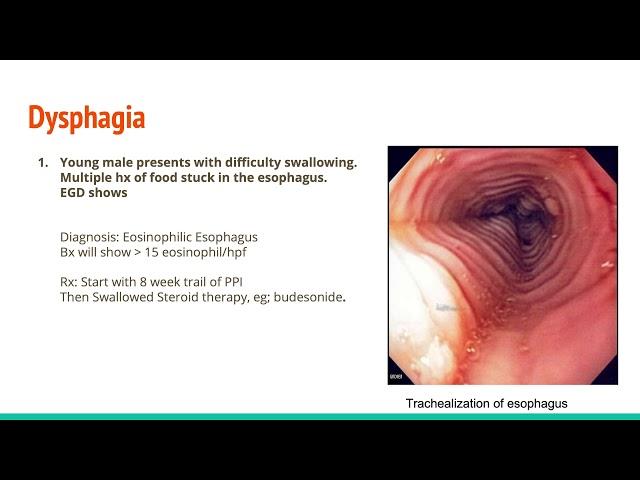 ABIM Internal Medicine Board Prep Series. Gastroenterology and Hepatology Part 1