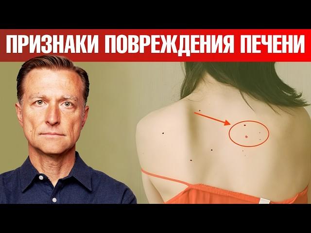 7 РАННИХ признаков повреждения печени 