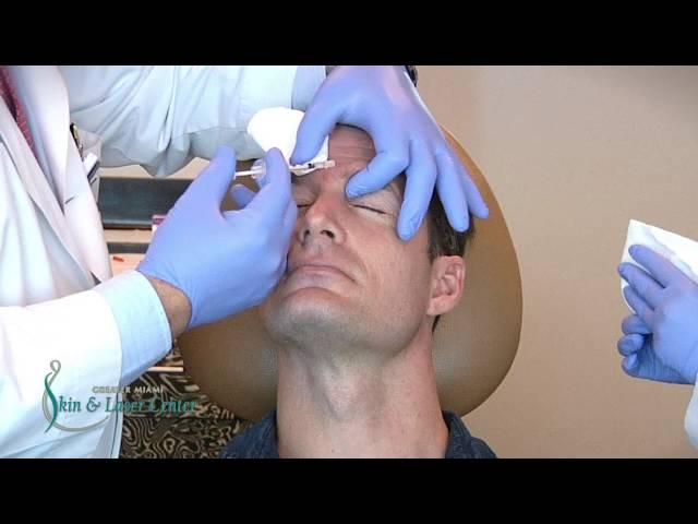 BroTox Treatment by Dr. Marty Zaiac