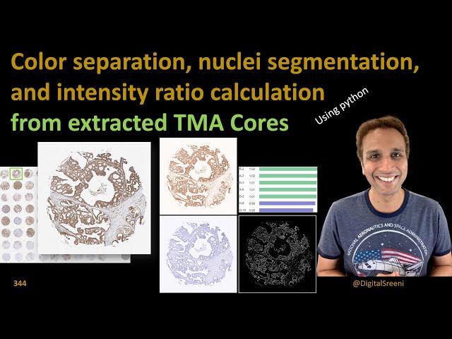 344 Color separation and nuclei segmentation in cores extracted from TMA