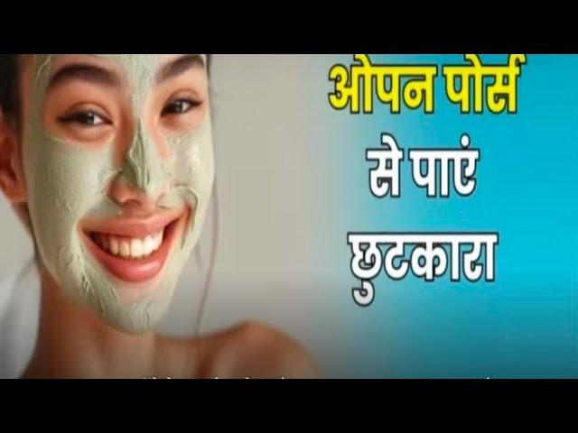 ओपन पोर्स को हटाने का रामबाण इलाज | How to get rid of open pores