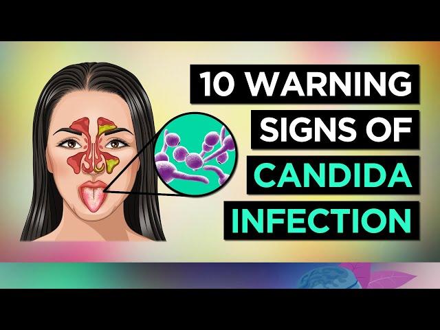 10 Symptoms of CANDIDA OVERGROWTH (Yeast Infection)