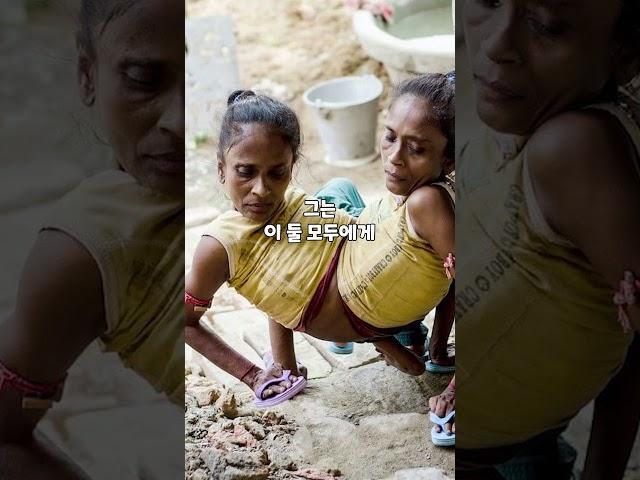 샴쌍둥이 자매와 사랑에 빠진 남자