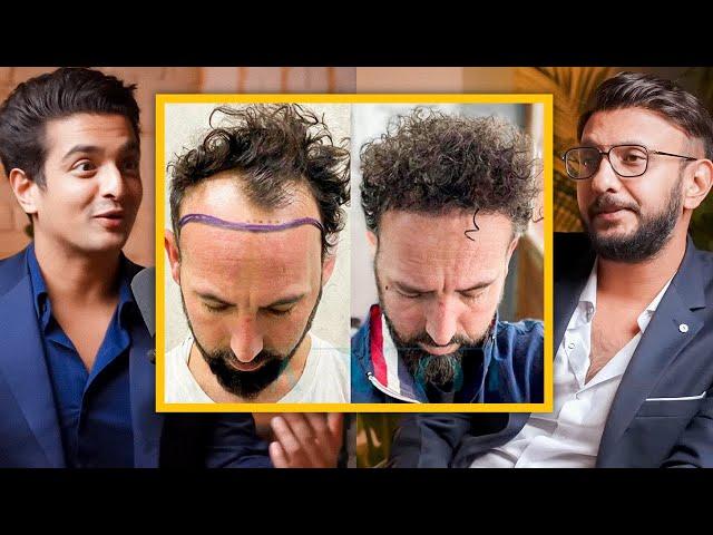 DON'T GO TO TURKEY For Your Hair Transplant - Top Indian Doctor Explains Why