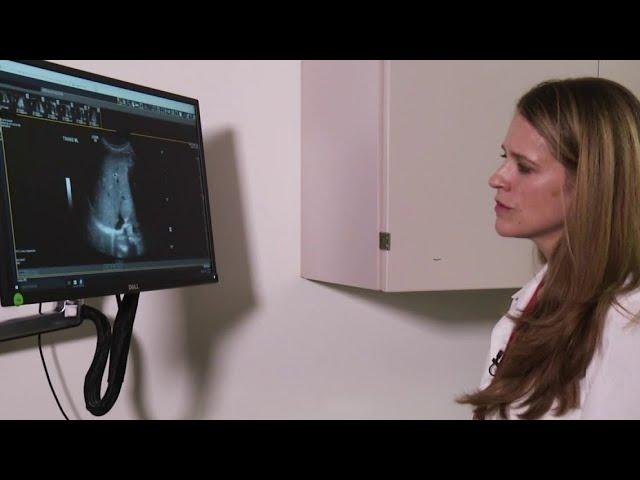 Nerve transfer surgery for AFM is a surgical first