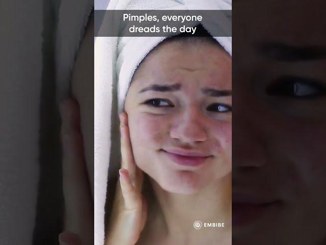 Why do we get pimples? | Interesting Facts | Ankana Kumari | Embibe | Shorts