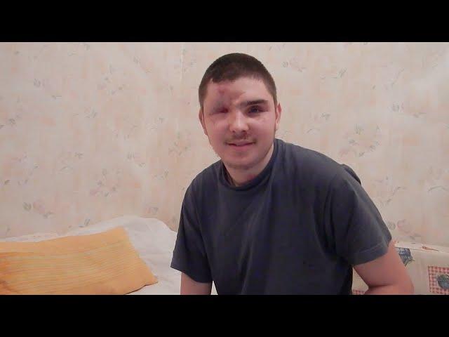 Миша Матвиенко: Мир наступит, когда люди поймут, что идет война