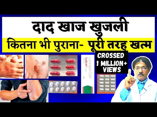 Dad Khaj Khujli Ki Dawa | दाद खाज खुजली को जड़ से ख़तम कैसे करे? | 3 Best Medicine For Dad Khaj Khujli