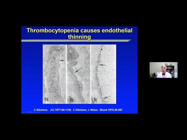 Dr David Kuter   How I treat ITP Presentation