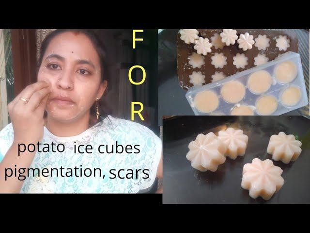 #potato ice cubes#DIY#for #dark spots#pigmentation