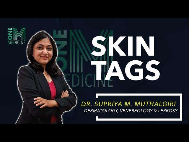 Skin Tags | Dermatology | OneMedicine