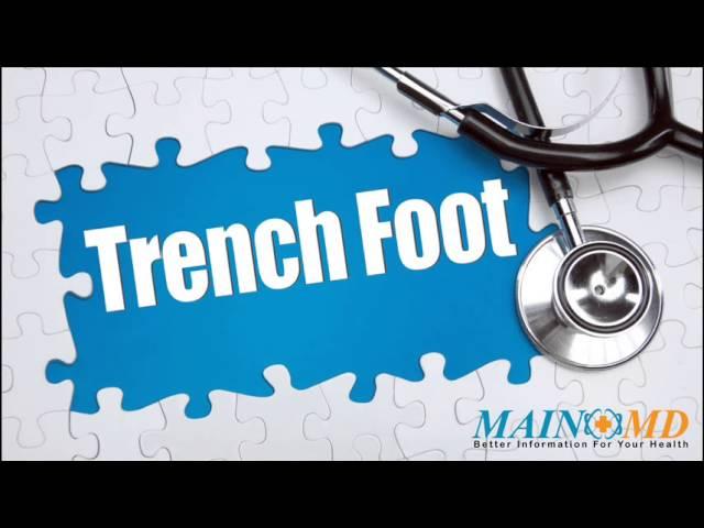 Trench Foot ¦ Treatment and Symptoms