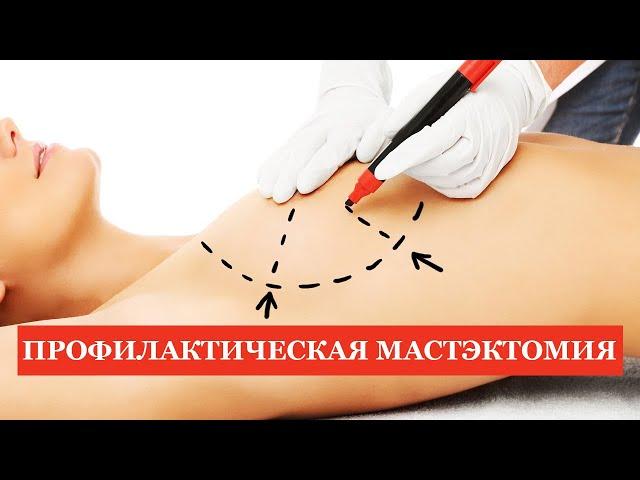 Профилактическая мастэктомия. Фиброаденомы. Внутрипротоковые папилломы.