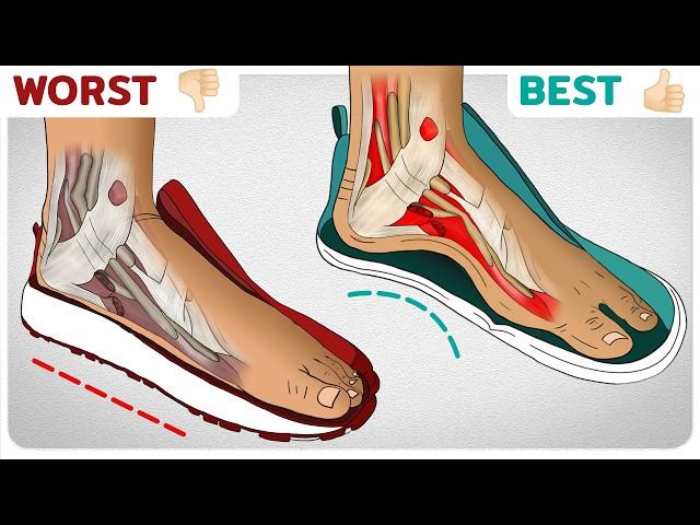 The Best Shoes for Flat Feet (Top 7 Picks)