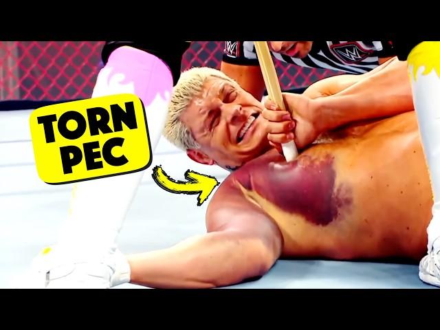 Doctor Reacts To Painful WWE Injuries