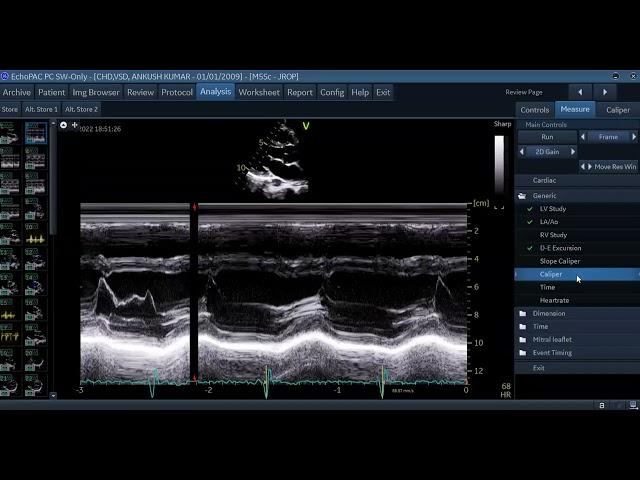 46th Basic Course of Echo, 16-10-22 Measurements-3