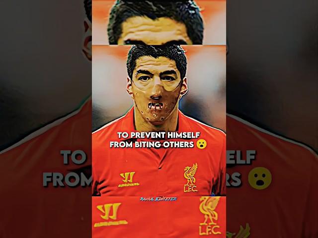 Why do players wear masks? | #suarez #masks