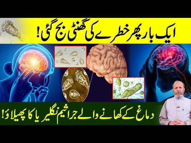 Amoeba Virus Spreading in Karachi | 2 Causalities | Dr. Muhammad Arshad Official