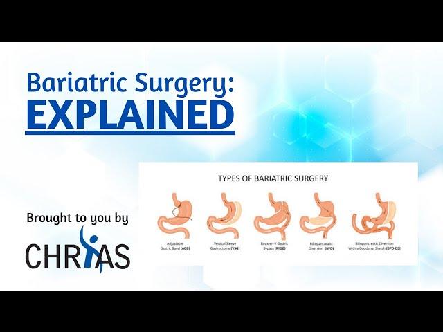 Bariatric Surgery: Explained