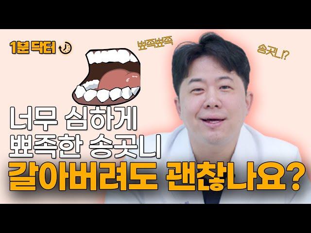 [1분닥터]송곳니, 유전으로 너무 뾰족한데... 갈아버릴 수 있나요?