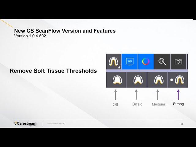 CS ScanFlow - Soft Tissue Removal Feature