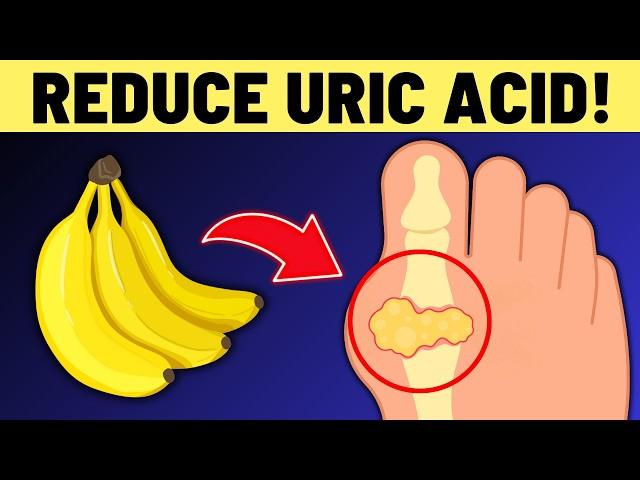 Top 10 Foods That Reduce Uric Acid Levels Naturally | VisitJoy