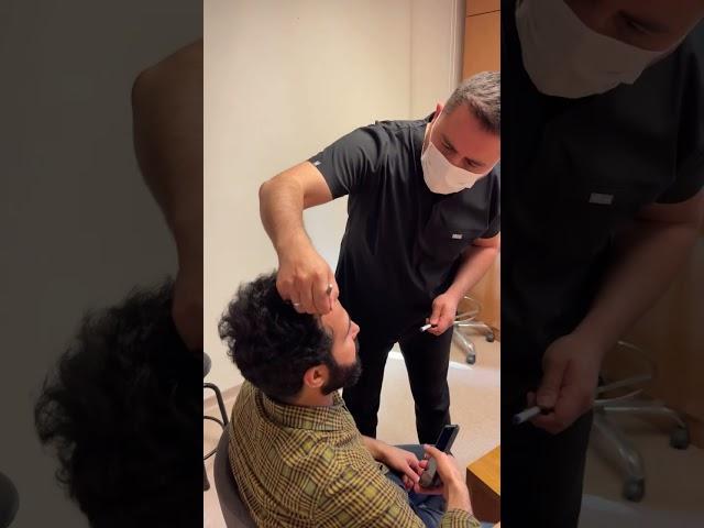 Hair Transplant day of a patient  - Dermatolog Dr. Mustafa TÜMTÜRK