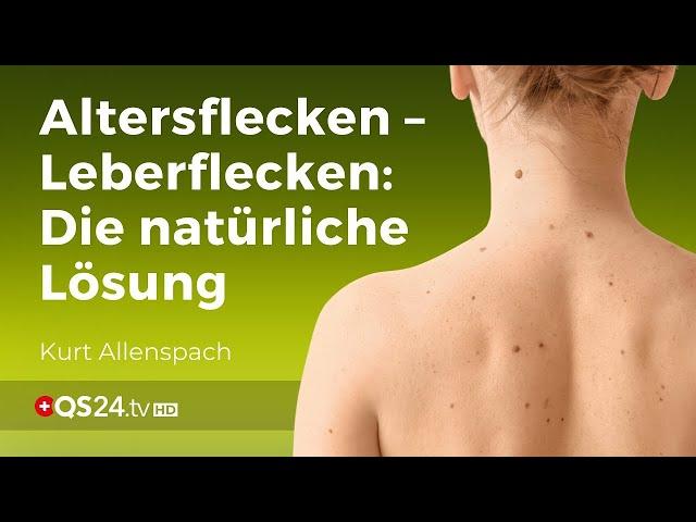 Altersflecken – Leberflecken: Die natürliche Lösung | Naturmedizin | QS24 Gesundheitsfernsehen