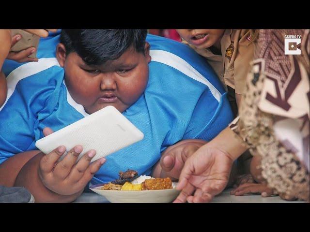 Morbidly Obese Boy Who Once Weighed 423 Pounds Gets Weight Loss Surgery