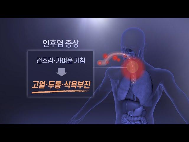 [건강쏙쏙] 겨울철 심해지는 인후염…방치하면 합병증 위험 / 연합뉴스TV (YonhapnewsTV)