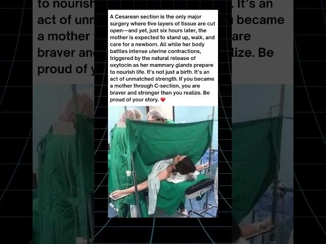The Silent Strength of C-Section Mom