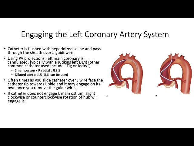 Left Heart Catheterization - an introduction.