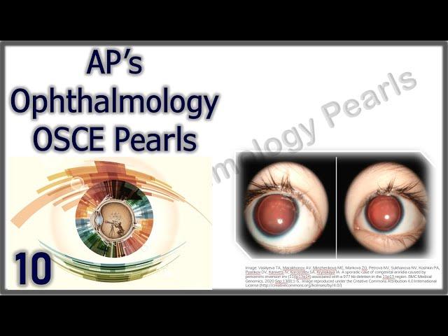 AP's Ophthalmology OSCE Pearls 10