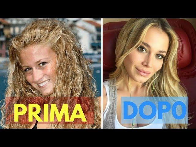 Vip rifatti-prima  e dopo