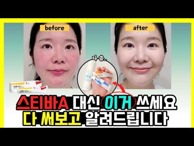 디페린 아크리프 투앤티크림 다 써본 찐 후기 (스티바A 대체약 3가지)