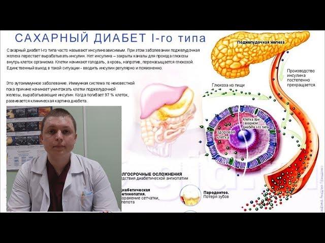 МЕГА 3 | Сахарный Диабет | Лечение | Omega 3 and Diabetes