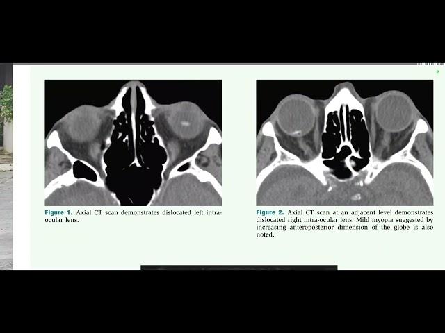 BRAIN AND SPINE RADIOLOGY TEACHING FILE