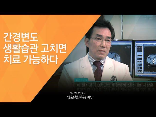 간경변도 생활습관 고치면 치료 가능하다 - (2011.2.12_361회 방송)_당신의 간이 굳어간다 침묵의 질환, 간경화!