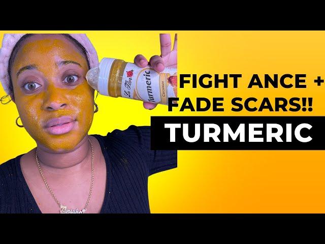 DIY TURMERIC FACE MASK!!! DAY 2